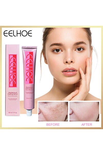 EELHOE Whitening Repair Pigmentation Serum, Melasma Brightening, Dark Spots, ...