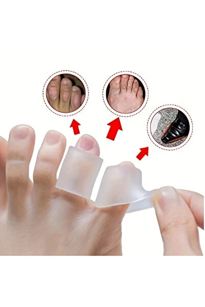 Choice 2Pcs/lot Silicone Gel Little Toe Tube Corns Blisters Corrector Pinkie ...