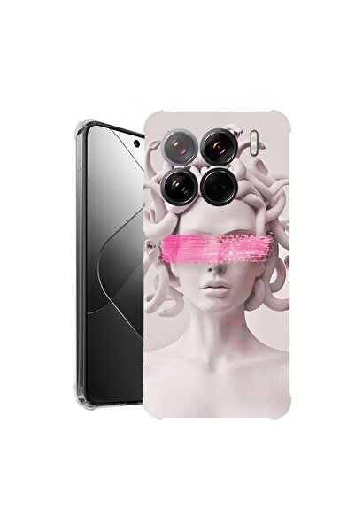 bestcase Θήκη για Xiaomi 15 Pro, Αντικραδασμική 1.5MM, Μέδουσα, Προστασία κάμ...