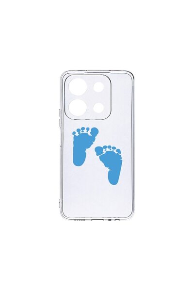 bestcase Husa BestCase¬Æ Clear Silicon 2MM, Compatibila Cu Xiaomi Redmi Note ...