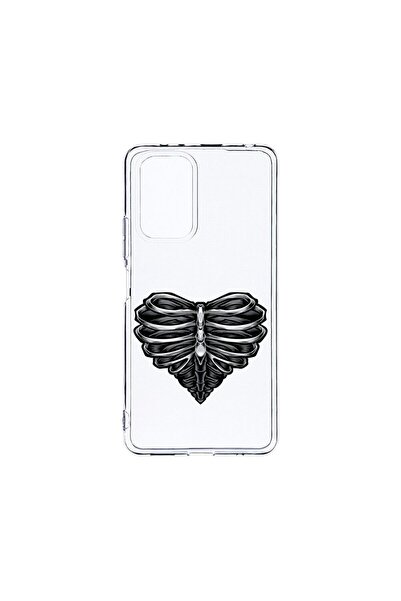 bestcase Husa BestCase¬Æ Clear Silicon 2MM, Compatibila Cu Motorola Moto G04,...