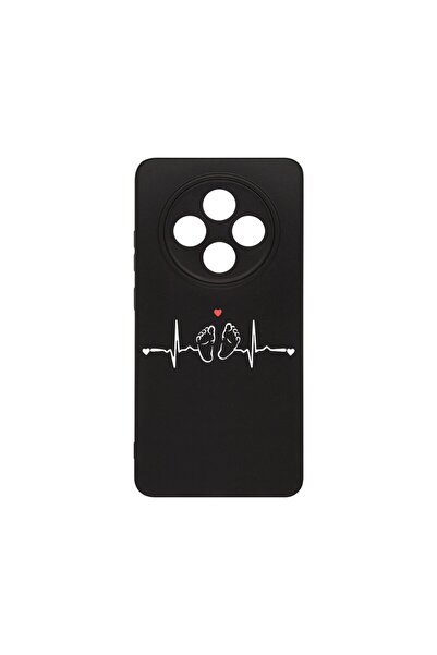 bestcase Λεπτή Θήκη Σιλικόνης 0.8MM, Συμβατή με Oppo Reno12 F / Reno12 FS, My...