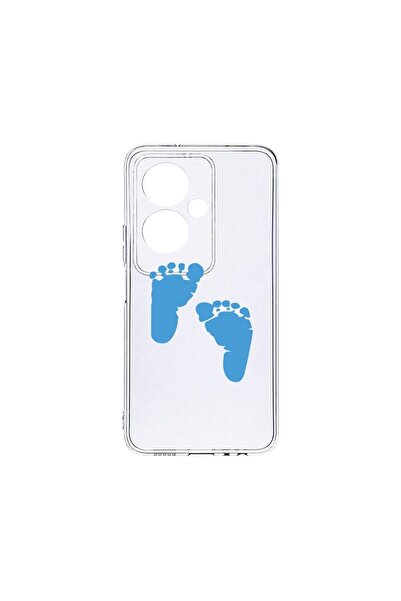 bestcase Husa BestCase¬Æ Clear Silicon 2MM, Compatibila Cu OPPO A79 5G, Boy F...