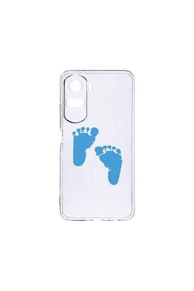 bestcase Διαφανής Θήκη Σιλικόνης 2MM, Συμβατή με Honor 90 Lite 5G, Σχέδιο Ποδ...