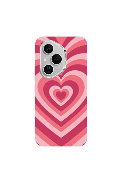 Other Honor Magic 400 Pro Hypnotizing 2 Transparent Silicone TPU Θήκη