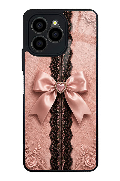 Spoyi Omix X6 Pink Lace Bow Tasarımlı Glossy Telefon Kılıfı