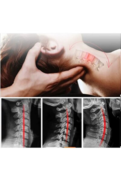 OEM Dispozitiv cervical Alphay 4-în-1 - Masaj, Fizioterapie, Negru