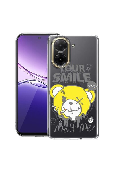 bestcase ¬Æ Husa Clear Slim Silicon Compatibila cu Xiaomi Redmi A5 ( 171 mm )...