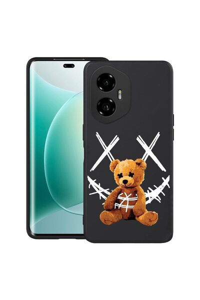 bestcase ¬Æ Husa pentru Honor 300 cu Design Teddy Bear Smile, TPU Mat Ultra S...
