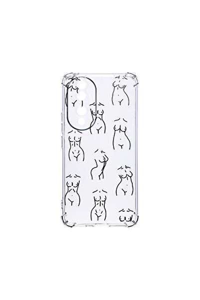 bestcase Husa BestCase¬Æ Anti Shock 1.5MM, Compatibila Cu Honor 90, Body Patt...