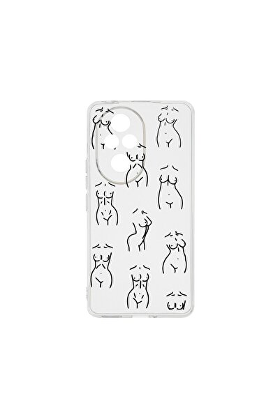 bestcase ¬Æ Husa Clear Silicon 2MM, Compatibila Cu Honor 200, Body Pattern, A...