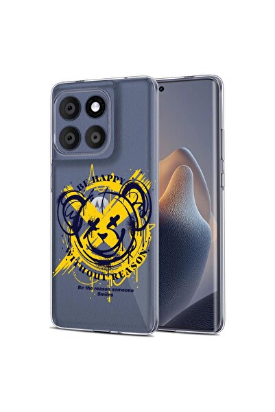 bestcase Θήκη για Motorola Edge 60 Fusion 5G, BestCase™ Διαφανής Σιλικόνη 2MM...