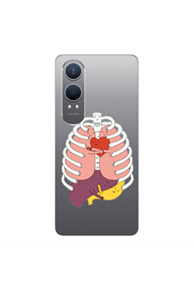 Other Oneplus Nord Ce 4 lite Anatomy Transparent Silicone TPU Θήκη