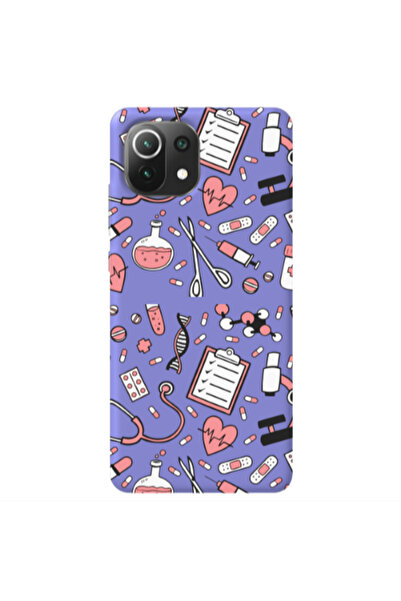 Other Xiaomi Mi 11 Lite Laboratory Purple Colored Silicone TPU Θήκη