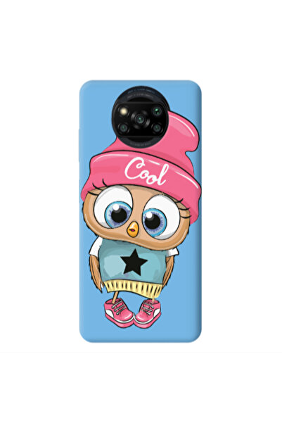 Other Xiaomi Poco X3 /X3 Pro Cool Star Blue Colored Silicone TPU Θήκη