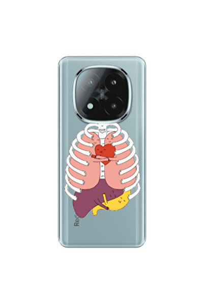 Other Xiaomi Redmi Note 14 Pro + 5g Anatomy Transparent Silicone TPU Θήκη
