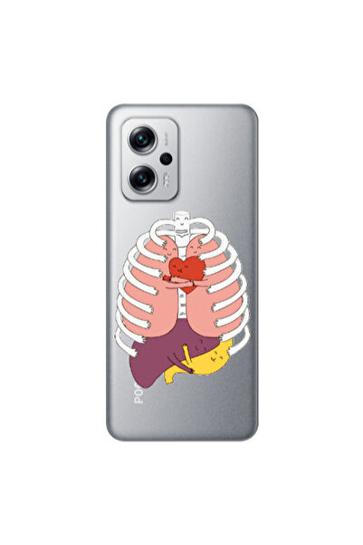 Other Xiaomi Poco X4 GT Anatomy Transparent Silicone TPU Θήκη