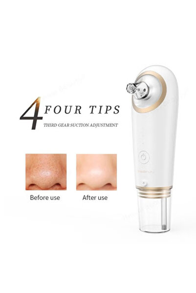 Boyue Small Bubble Blackhead Remover Water Circulation Electric Pore Cleaner ...