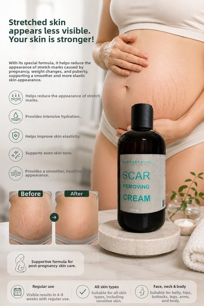Puredermine Powerful Formula for Belly Stretch Marks and Scars & Achieve a Smoother, More Flexible, and Healthier Skin Appearance