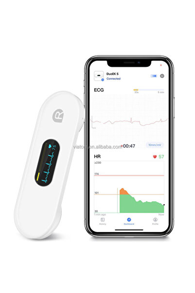 Choice Pocket ECG Monitoring Device with OLED Screen Bluetooth EKG Monitor fo...