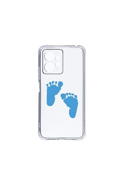 bestcase Husa BestCase¬Æ Anti Shock 1.5MM, Compatibila Cu Xiaomi Redmi Note 1...