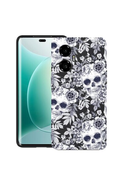 bestcase Θήκη για Honor 300 με σχέδιο κρανίου, Μαύρο και Λευκό, TPU Ματ Εξαιρ...