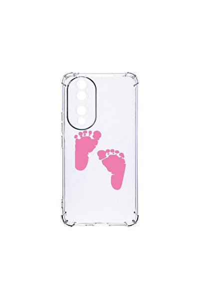 bestcase Husa BestCase¬Æ Anti Shock 1.5MM, Compatibila Cu Honor 90, Girl Feet...