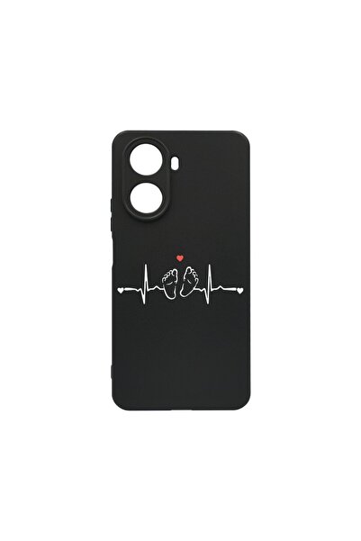 bestcase Λεπτή Θήκη Σιλικόνης 0.8MM, Συμβατή με Huawei Nova 10 SE, My Little ...