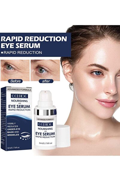 Arabest Eye Serum,Anti-Aging Rapid Reduction Serum,Visibly Reduces Under-Eye ...