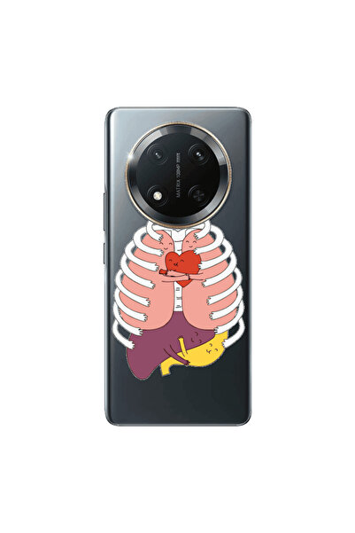 Other Honor Magic 7 Lite Anatomy Transparent Silicone TPU Θήκη