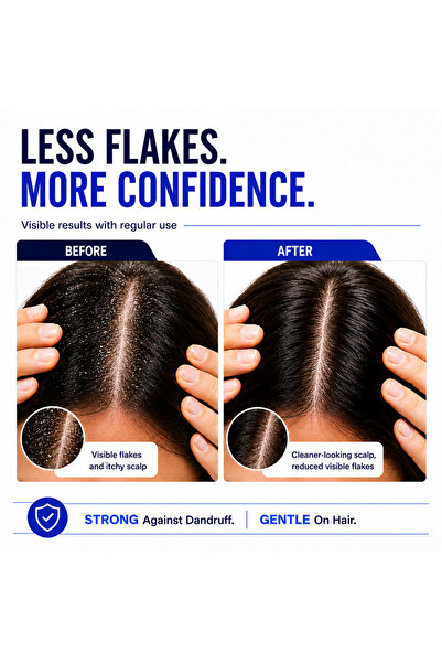 SEBIZOLE -SHAMPOO Anti Dandruff 100ML-sebizole
