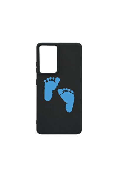 bestcase Λεπτή Θήκη Σιλικόνης 0.8MM, Συμβατή με Honor 200 Lite, Σχέδιο με πατ...