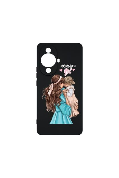bestcase Husa BestCase¬Æ Premium Liquid Silicon, Compatibila Cu Huawei nova 1...