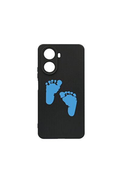 bestcase Λεπτή Θήκη Σιλικόνης 0.8MM, Συμβατή με Huawei Nova 10 SE, Σχέδιο Πατ...