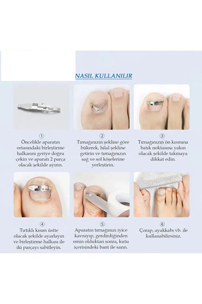 ORVİCA Paslanmaz Çelik Tırnak Batması Engelleyici , Batık Tırnak Çıkartıcı ( 1.7 Cm - 3Cm Arası Uyumlu )