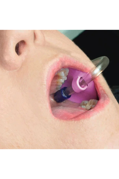 Choice 10pcs Autoclavable Dental Suction Tube Holder Oral Care Tools Saliva E...