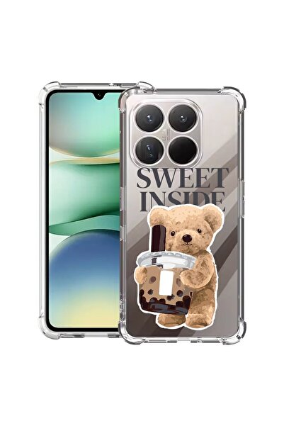bestcase Αντικραδασμική Θήκη 1.5mm Συμβατή με Motorola Moto G86 Power, με Σχέ...