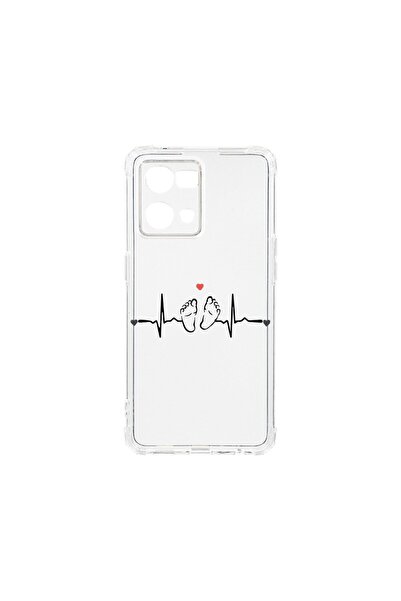 bestcase Anti Shock 1.5MM Case, Compatible with OPPO Reno 7 4G, My Little Lov...