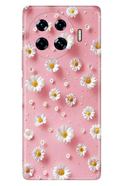 TECNO Spark 20 Pro+ Plus Kılıf Süslü Duvar Temalı Desenli Darbe Emici Silikon