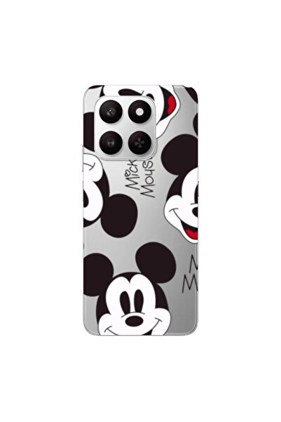 Other Honor Magic 400 Smart Mickey Mouse Transparent Silicone TPU Θήκη