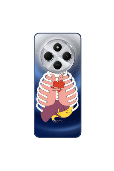 Other Xiaomi Redmi 14c Anatomy Transparent Silicone TPU Θήκη