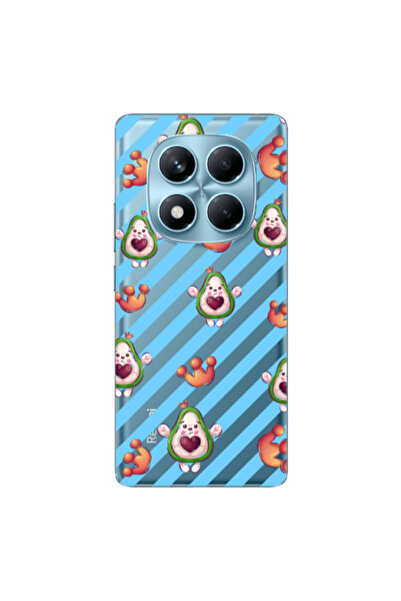 Other Xiaomi Redmi Note 14 Pro king avocado Transparent Silicone TPU Θήκη