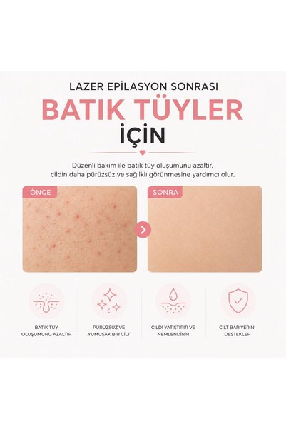 SMOOTH BATH Viskos Kese Dead Skin Removal and Skin Care for Oily and Combination Skin