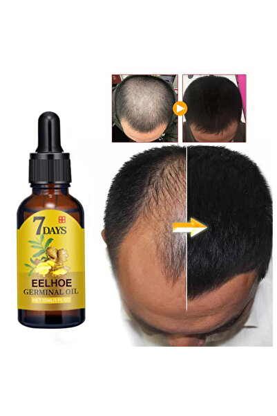 EELHOE 7 Days Germinal Oil Ginger Hair Growth Hair Caring Moisturizing Anti F...