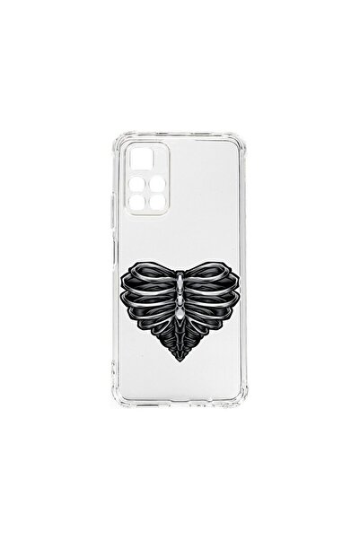 bestcase Husa BestCase¬Æ Anti Shock 1.5MM, Compatibila Cu Xiaomi Poco M4 Pro ...