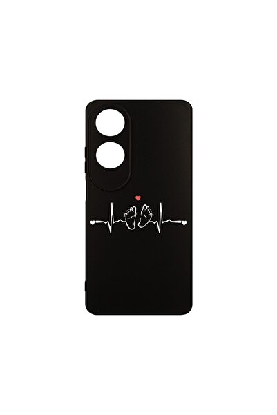 bestcase Husa BestCase¬Æ Slim SIlicon 0.8MM, Compatibila Cu OPPO A60, My Litt...