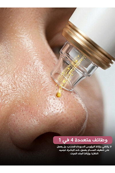 Yallabena 4 in 1 Facial Pore Cleaner Blackhead Remover Vacuum - Rechargeable