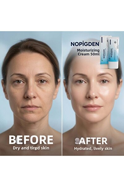 denge ilaç Nopigden Moisturizing Repair Cream 50 ml Daily Skin Care and Moist...