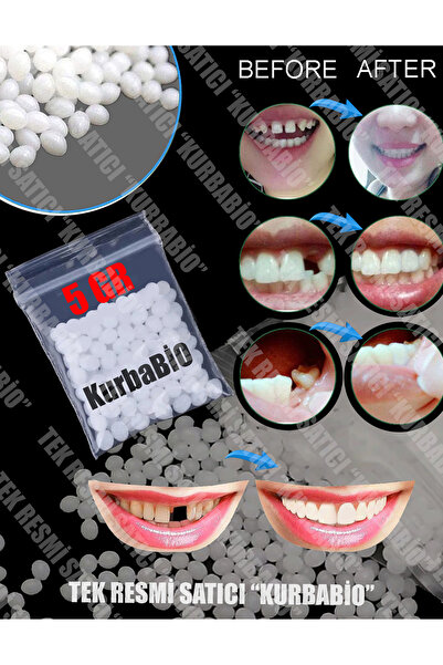 KURBE Pro Thermo Granül 5 Gram Protez Geçici Diş Yapımı, Eksik Diş Giderme, K...