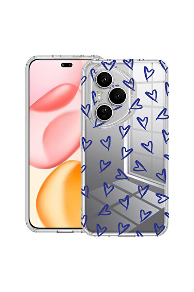 bestcase Αντικραδασμική Θήκη για Honor 400 Pro, με Χαριτωμένο Σχέδιο Καρδιές,...